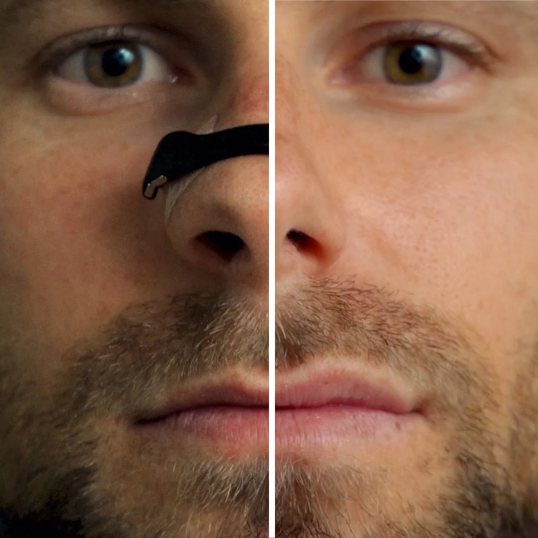 Magnetic Breathing Nasal Strips